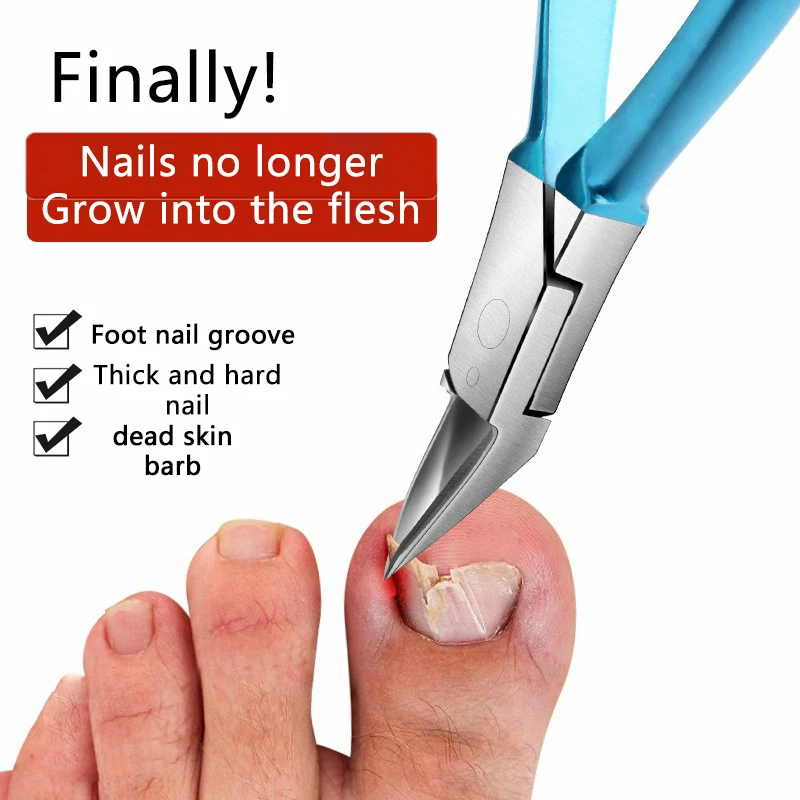 Cortauñas para dedos de los pies encarnados o gruesos, recortador de uñas de los pies, podólogo profesional, pinza para uñas de los pies con Supe de acero inoxidable