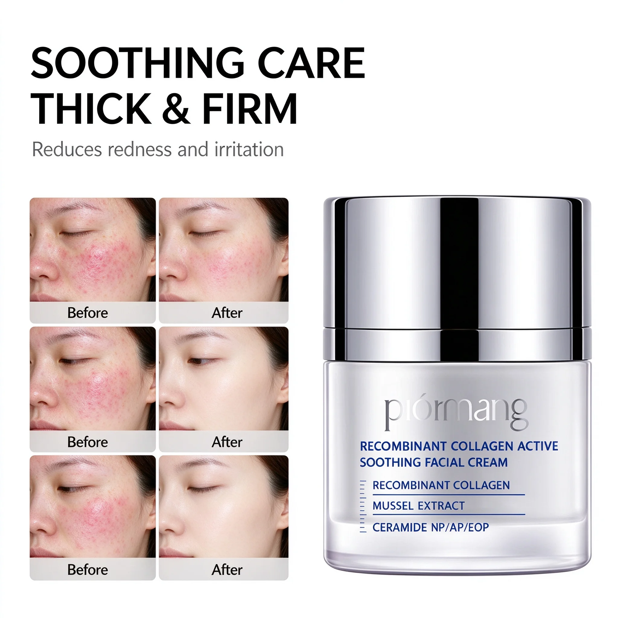 Sensitive Skin Repair Serum Recombinant Collagen Mussel Extract Ceramide Six Botanicals for Soothing Hydrating Nourishin