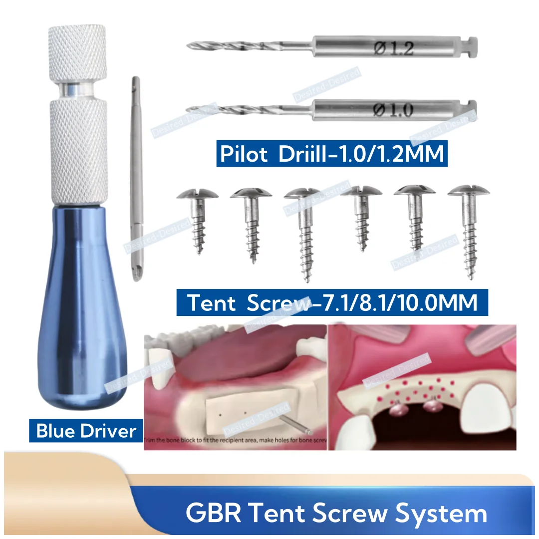

Стоматологическая система GBR: винты для тентирования, мини-сверла для тентирования, пилотные сверла 1.2, 1.0, сверла для предварительного просверливания кости