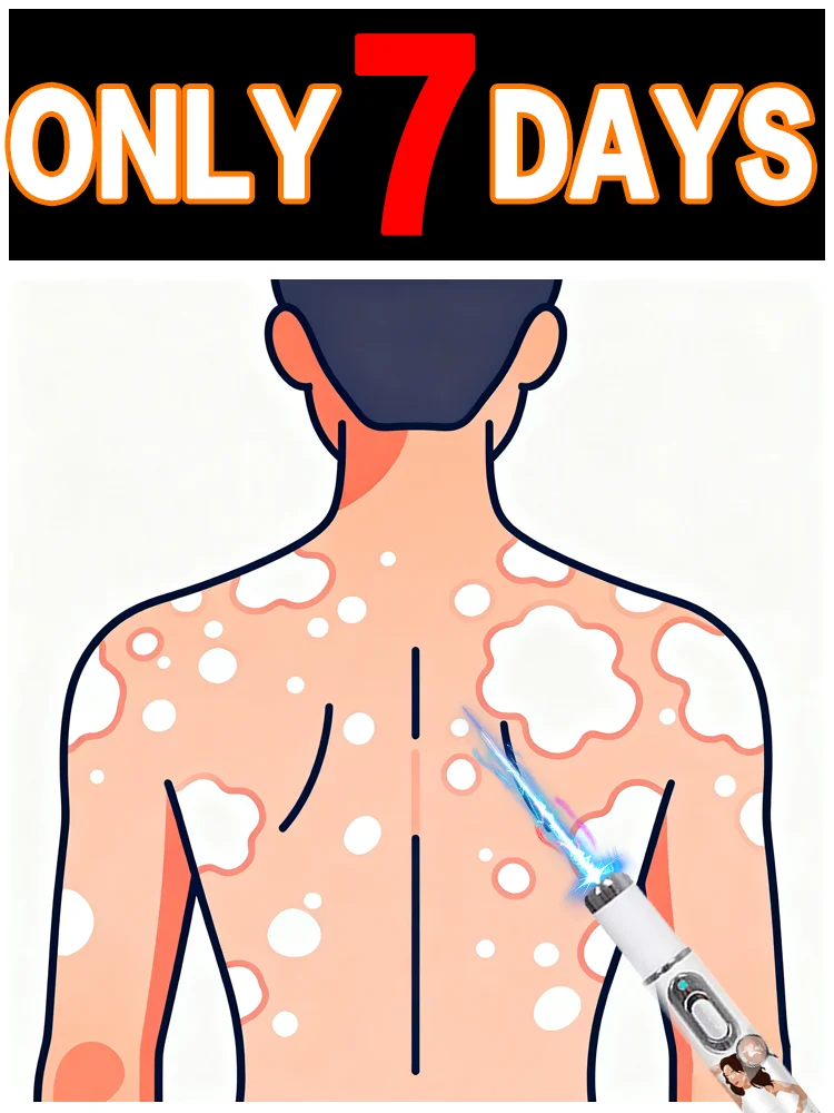 

Addressing vitiligo symptoms: The blue light assistive tool + blue pen combination easily supports daily skin care.