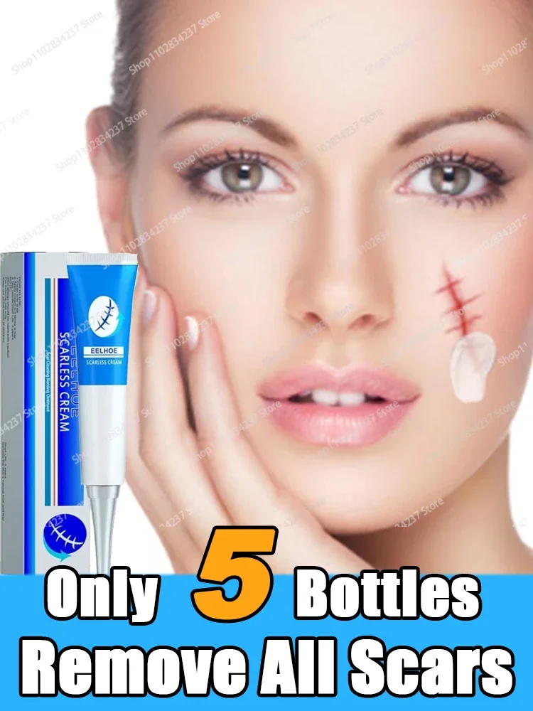 

Scar Repair Cream Skin Wound Cream Burning Fading Cream Surgery Repair Scar