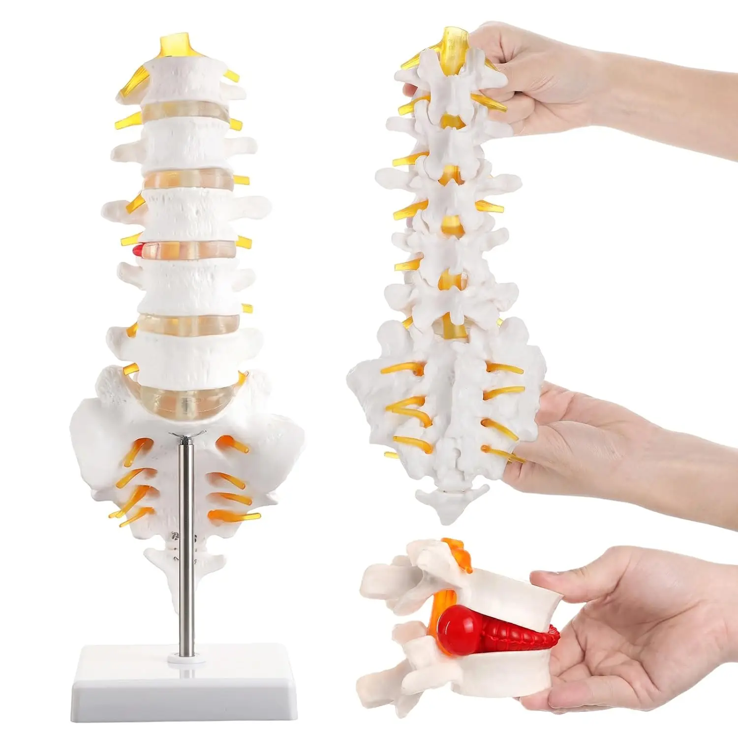 2Pcs Lumbar Spine Model with 5 Vertebrae and Herniated Disc Model Set for Medical Students Doctor Patient Education Chiropractic