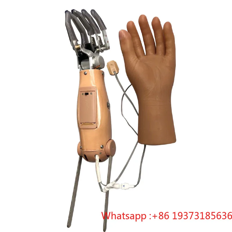 Medical Implants Prosthetic Limbs Myoelectric Control Elbow With Two Degrees Of Freedom For Hand Prosthesis