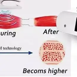 EMS MECAVIE Professional Body Shaping Machine 200Hz Muscle Stimulation Fat Burning Slimming Tool for Home Use