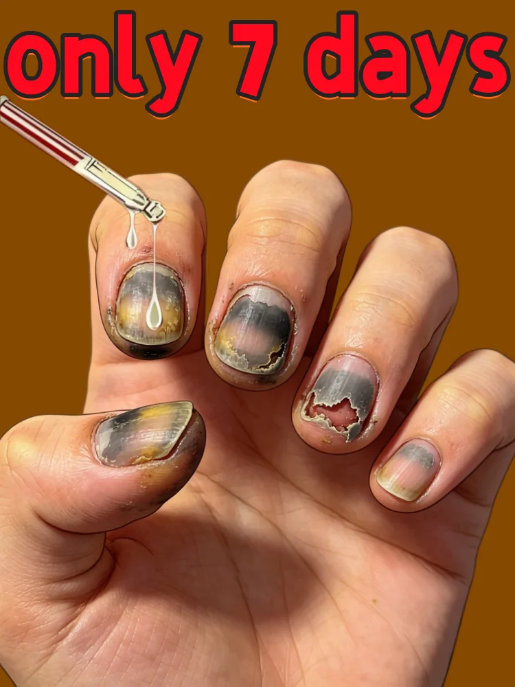 

Say Goodbye to Nail Troubles, 2026 2nd Gen Nail Cleaning Tools, Hot Sale Free Shipping