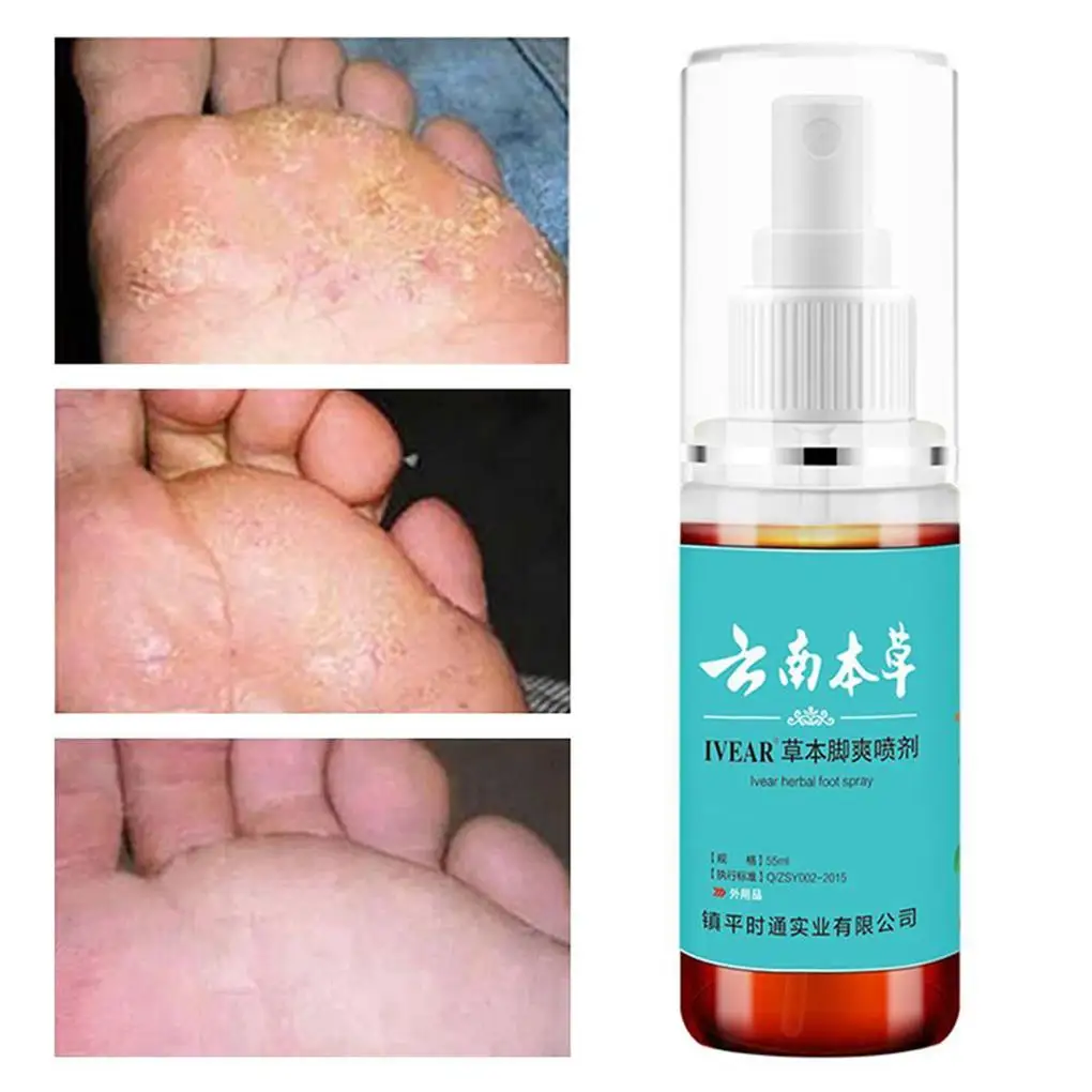 55ml Athlete’s Foot Spray Liquid Smelly Feet Spray Foot Spray For Athlete’s Foot Treatment Smelly Feet therapy