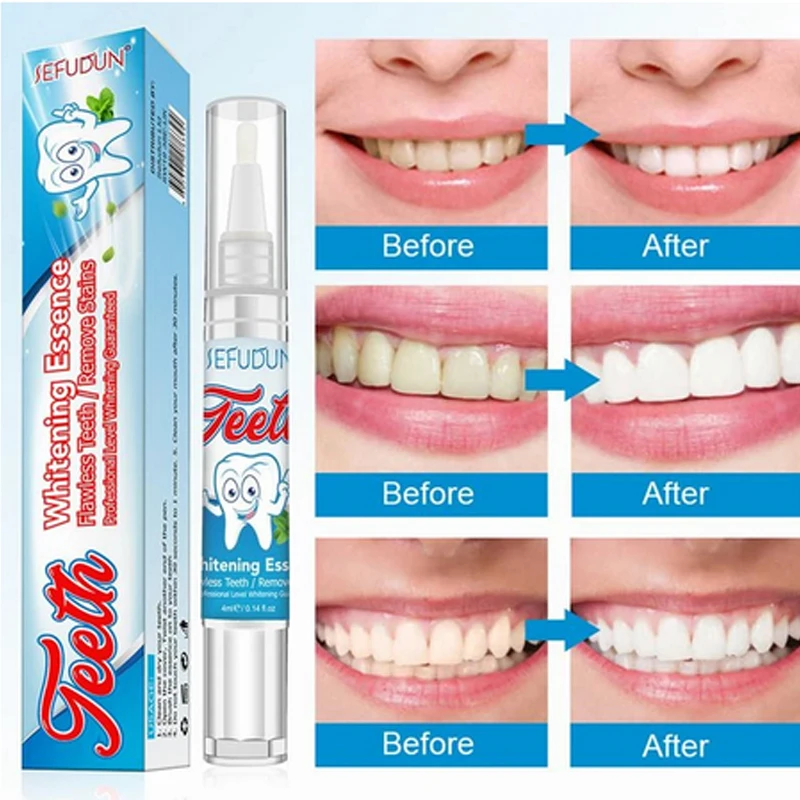 Teeth Whitening Pen Professional Teeth Gel Whitener Bleach Remove Stains Oral Hygiene Tooth Hygiene Care Tools Teeth Cleaning