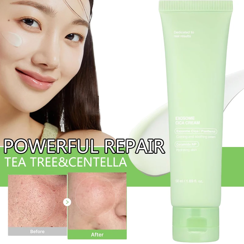 

Корейский крем-центелла с чайным деревом от прыщей, мощный для чувствительной кожи, уменьшает покраснение грузов, низкодражающий, увлажняющий, ежедневный уход