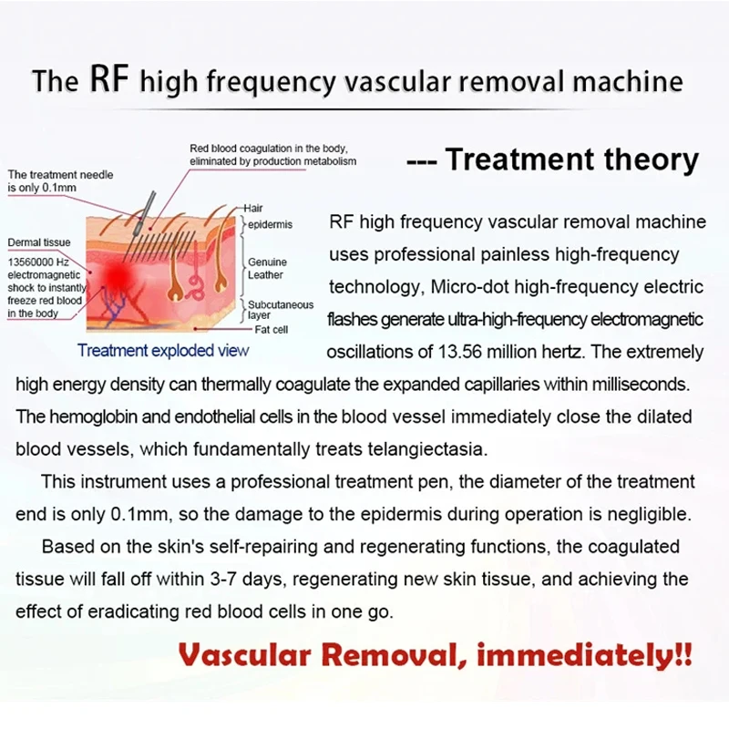 60W RF Vaso sanguigno rosso Rimozione vascolare Detergente per il viso Macchina di bellezza Ago ad alta frequenza Rimozione vene del ragno Strumento per la cura della pelle