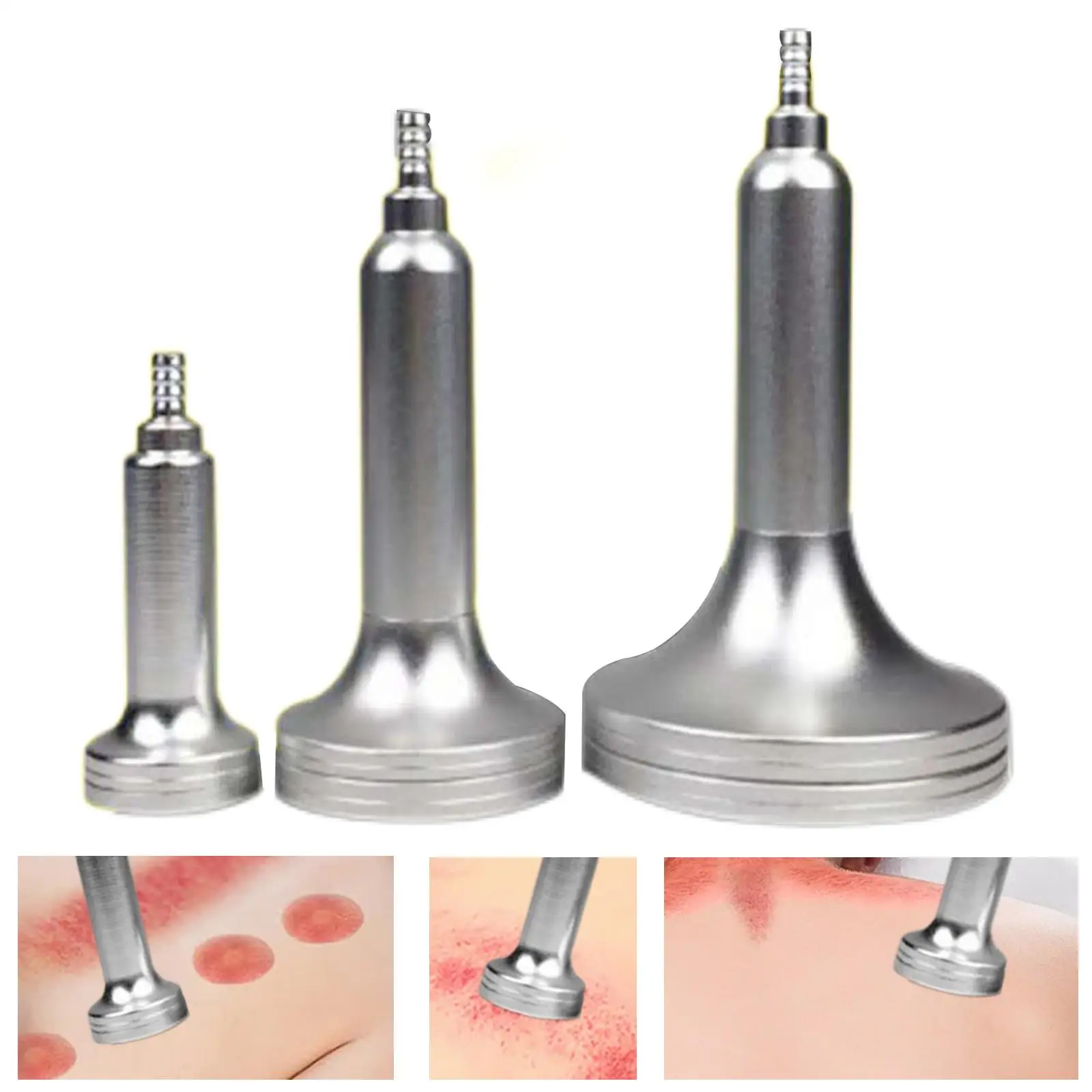 

3Pcs Vacuum Roller Sets Body Accs Vacuum Roller Cups Metal Roller for Neck