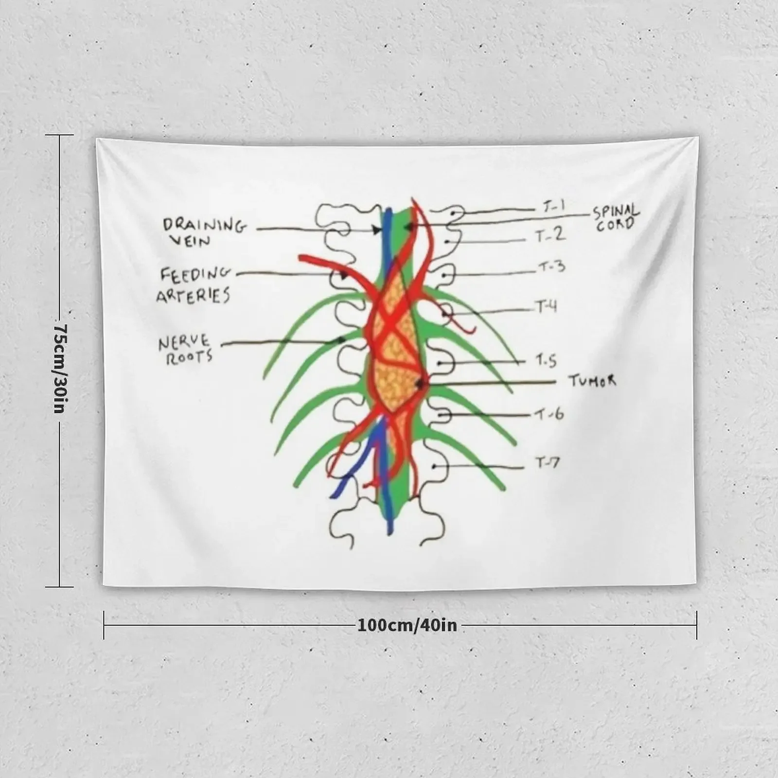 Greys - Spinal tumour Tapestry Art Mural Decoration Room Tapestry