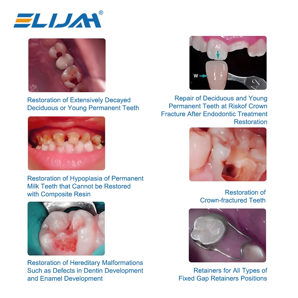 ELIJAH 48 stks/doos Dental Kid Kronen Voorgevormde Metalen Kroon Rvs Pediatrische Tijdelijke Kronen Pedo Molaire Kroon Refill Kit