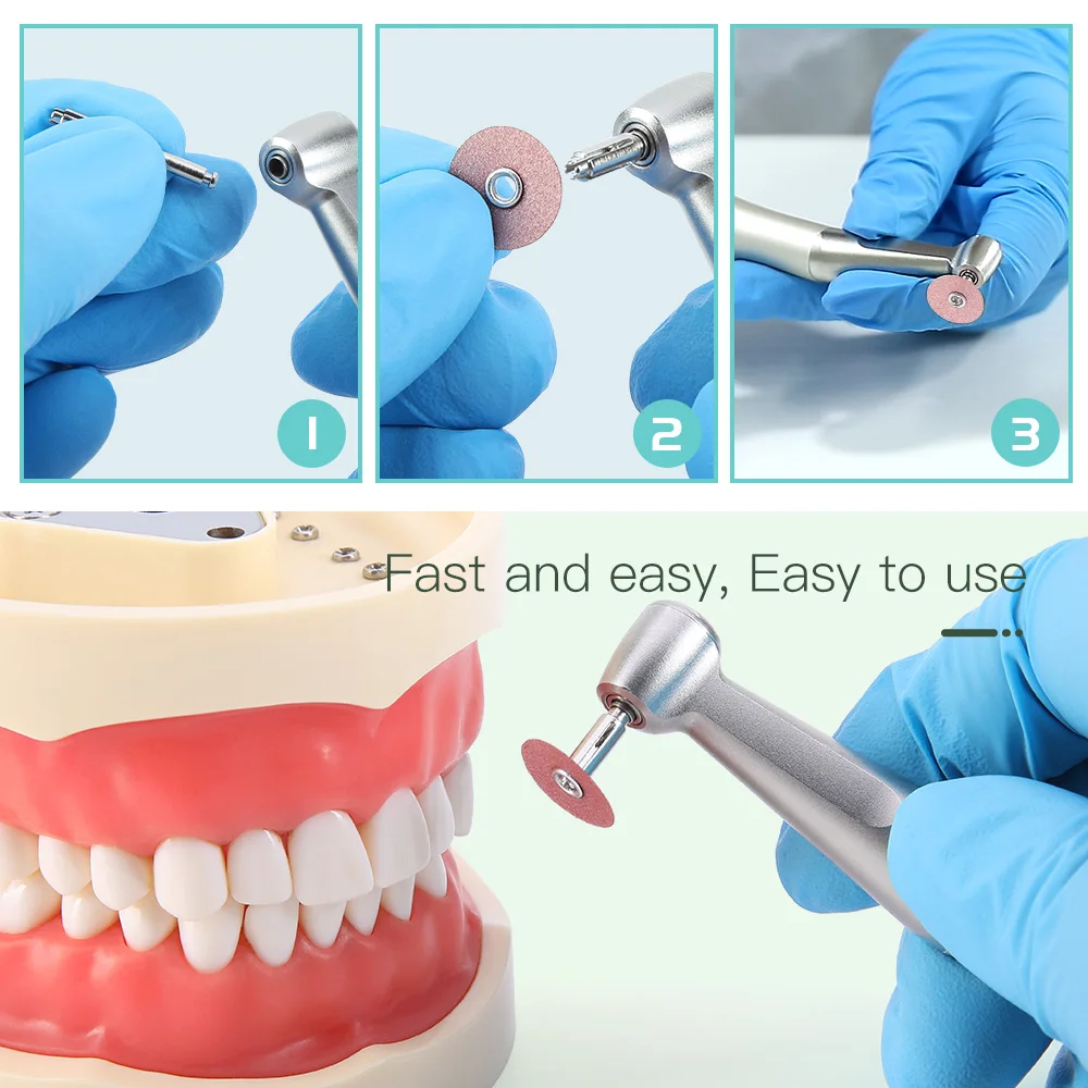 Dental Finishing and Polishing Discs for Composites Ceramics and Glass Ionomer Restorations Superfine/Fine/Medium/Coarse Type