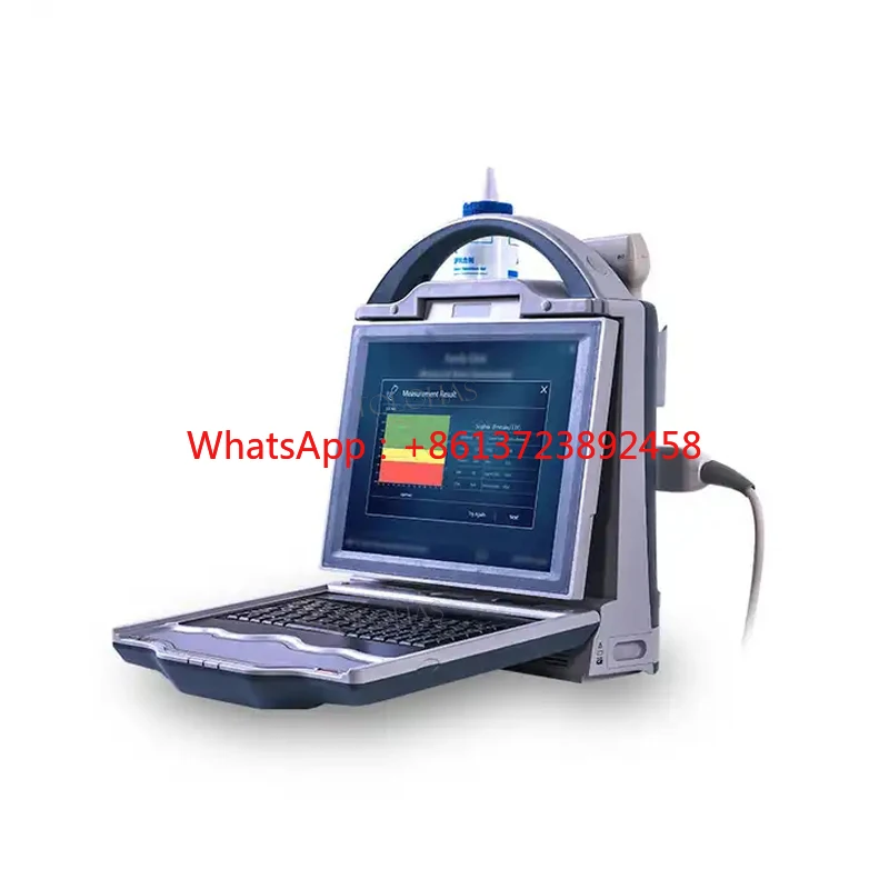 LHAA3 Ultrasound Bone Densitometer Bone Density Scanner Ultrasonic Bone Density Test Machine For Radius And Tibia