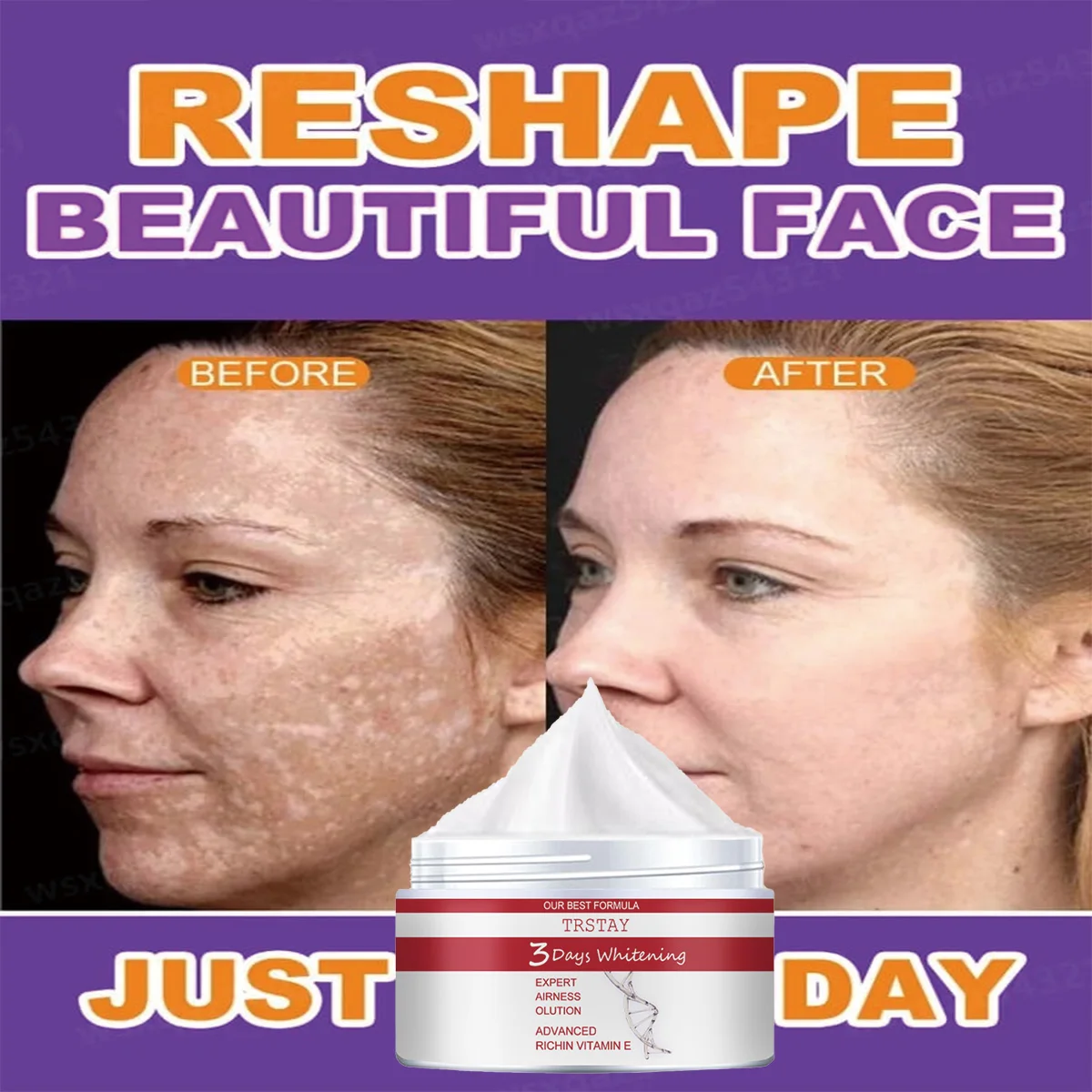 

Отбеливающий крем TRSTAY Advanced, 3-дневный, богатый селеном, витамин Е, увлажняющий уход за кожей лица для мам и детей