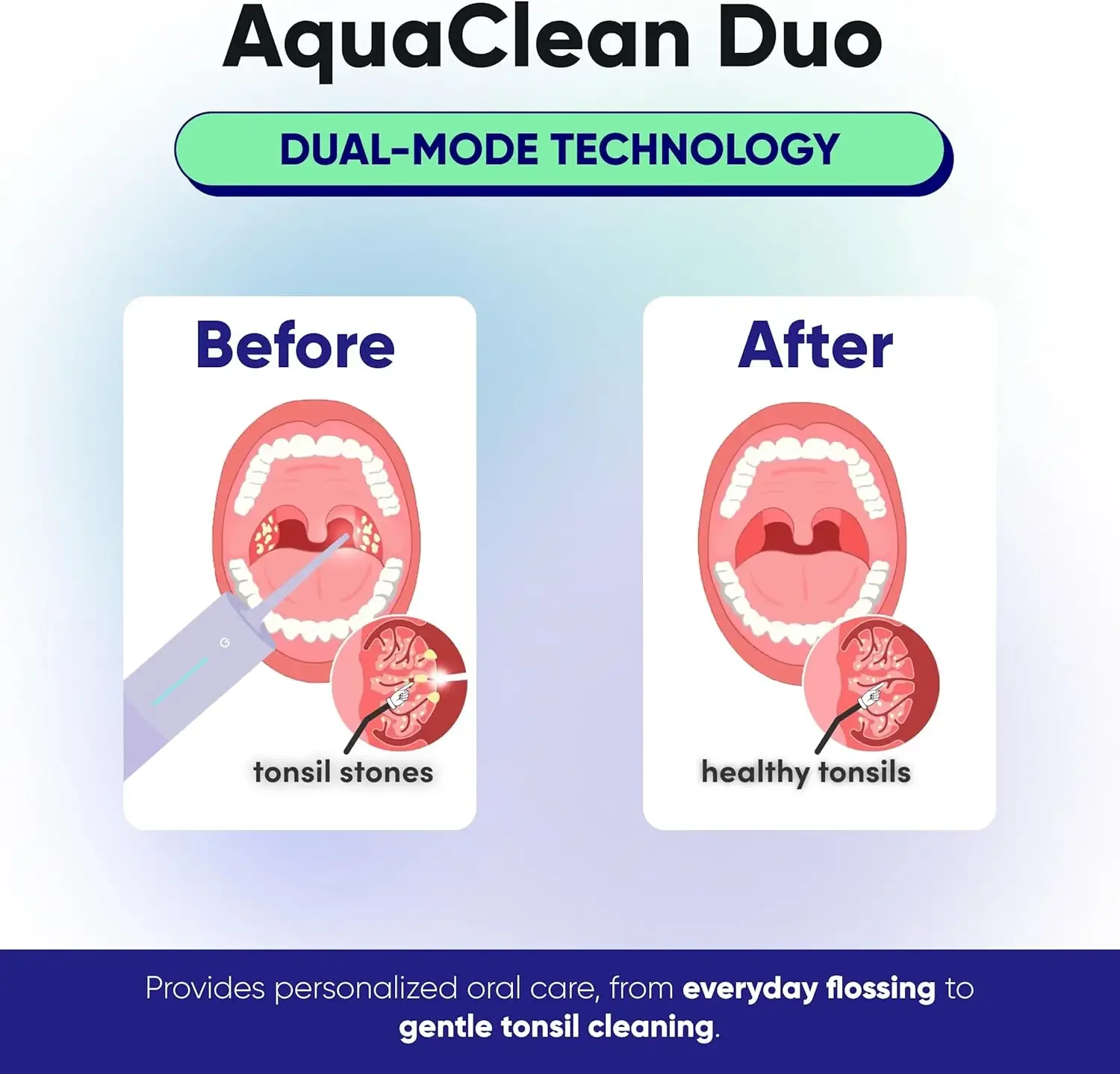 محمول، مقاوم للماء، يتضمن فوهات، وشاحن مغناطيسي، وحقيبة سفر |   طبيب الأسنان دي