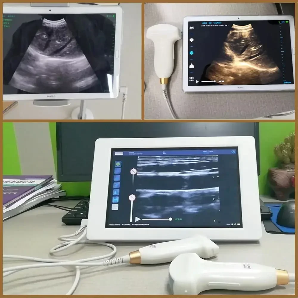 Veterinary Wired Ultrasound Scanner Portable Color Doppler 3.5/7.5Mhz Convex Probe for Andriod Phone with Type-c Port