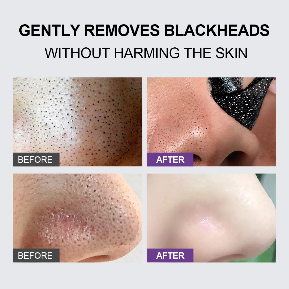 Bamboo Charcoal Blackhead Remover Mask Face Black Dot T-zone Nose Cleaning Women Men Black Head Removal Facial Masks Skin Care