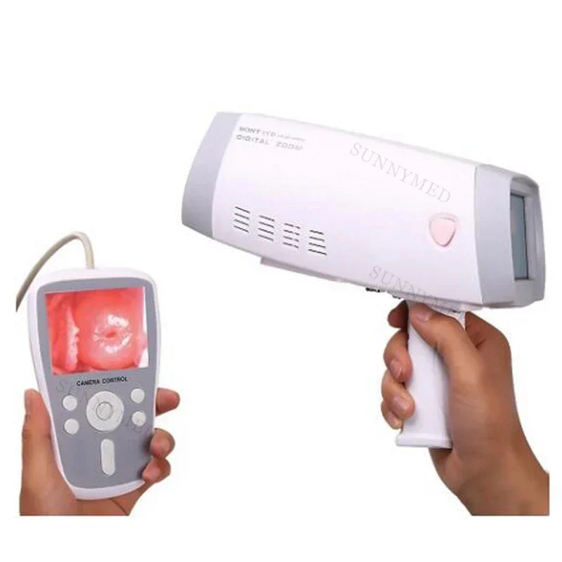 

SY-F005 Hot Sale Handheld Colposcope Video Medical Gynecology Colposcope with Software