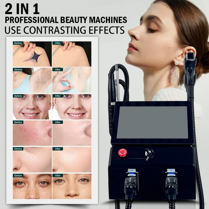 

Лазерная установка 2-в-1: пикосекундный лазер Ice Platinum для удаления татуировок и диодный лазер 808 нм для удаления волос, а также ND YAG лазер