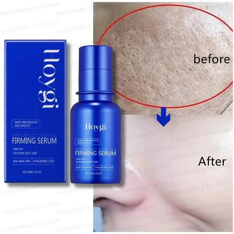 Blue Microneedle Shrink Pores Facial Essence Whitening Lifting Firm Fine Line Serum Moisturise Melanin Remove Skin Care Product