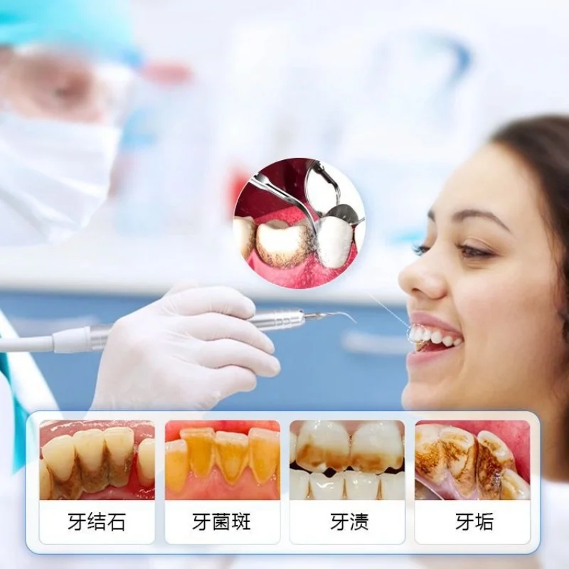 1 PC Dental Pneumatic Cleaning Machine High-frequency Ultrasonic Beauty Stone Removal Cleaning Machine
