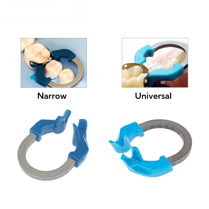 Dental Matrix System Sectional Contoured Autoclavable Matrix Band for Molar Restoration Dentistry Tool