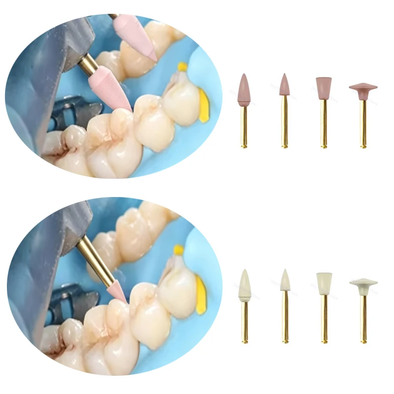 1 Box Dental-Gummi-Polierer, Komposit-Harz-Diamant-Polierscheiben-Set, Polier- und Schleifköpfe für die Zahnmedizin – Detail 5