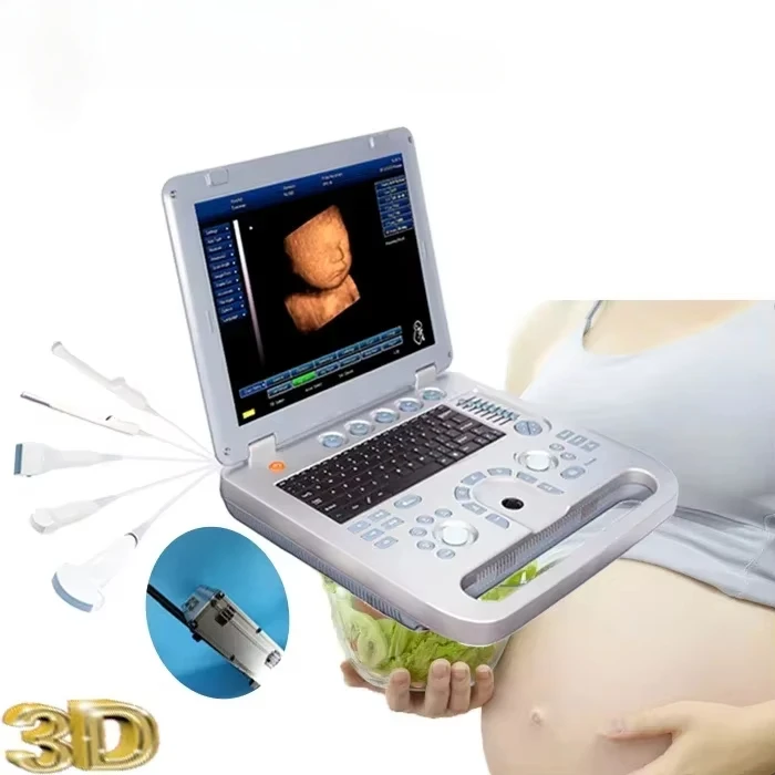 Cheapest price Laptop Digital 15 inch 2D 3D 4D obstetric gynecology ultrasound medical scanner