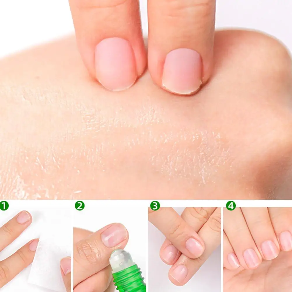 Nail Repair Oil for Nails Nourishing Cuticle Oil, Moisturizing Treatment Dry Cracked Cuticles and Dead Skin Nail Strengthener