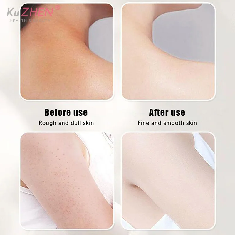 Guantes de baño para hombre y mujer, cepillo de ducha exfoliante para SPA, manopla exfoliante para limpieza corporal, guantes para frotar la piel muerta, toalla de ducha, masaje corporal de espuma