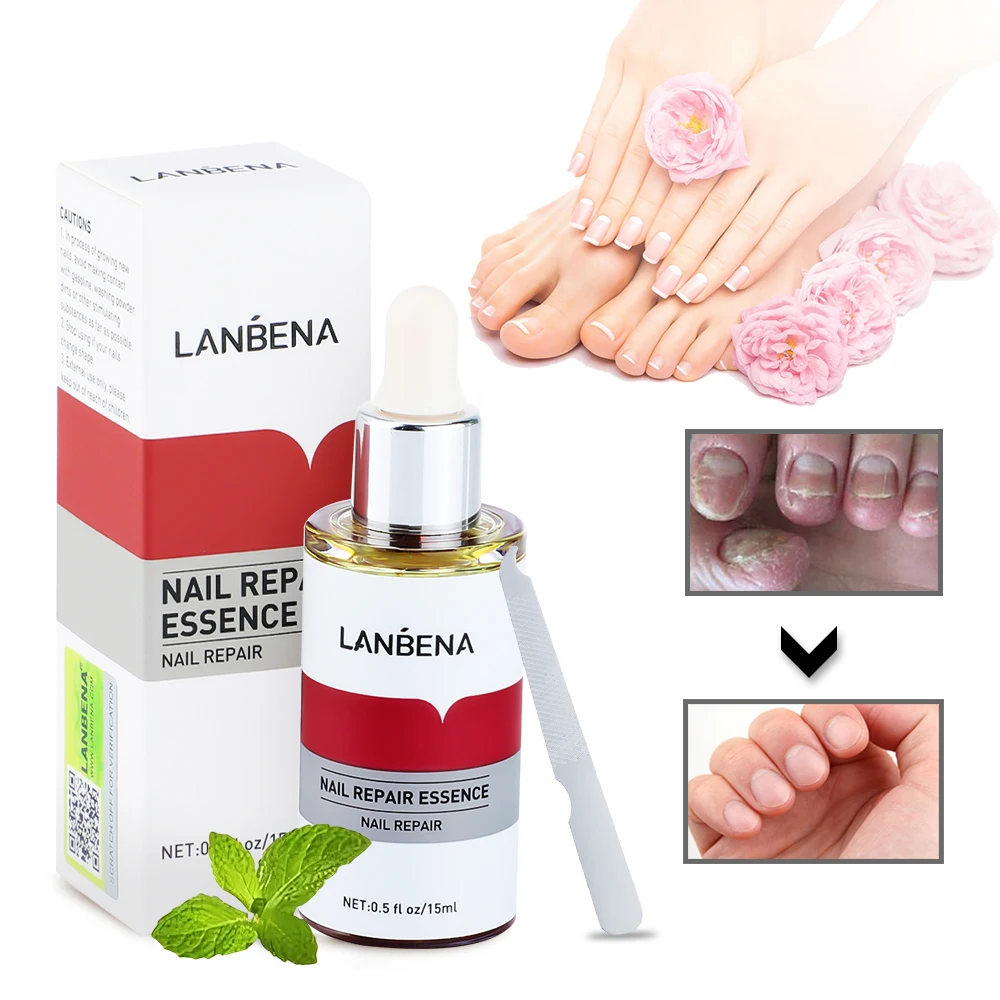 LANBENA 15ml Nail Repair Essence Serum Anti Infection Paronychia Onychomycosis Treatment Foot Care Nail Fungus Removal Gel