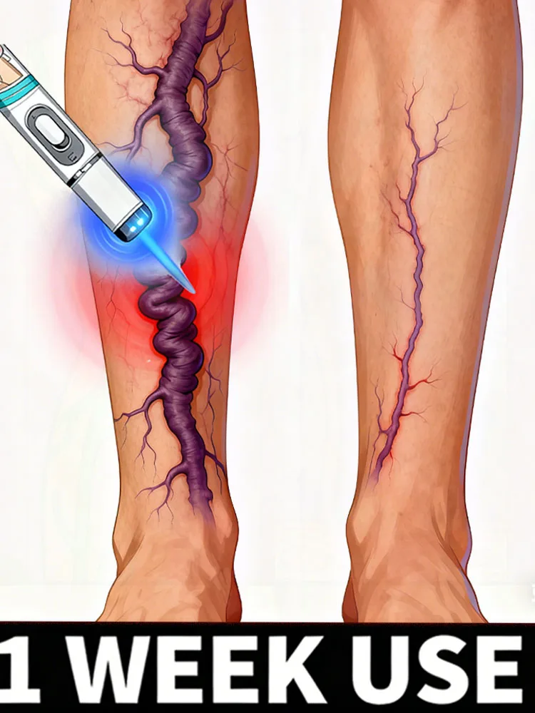 

Бестселлер 2025, универсальный набор инструментов для ухода за ногами Blue Light Pen