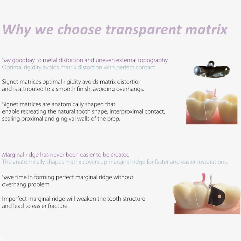 Dental Clear Matrix Posterior Fits Bioclear Transparent BT Matrices Molar Composite Class Restorative 4.5/5.5/6.5/8.0 0.038mm