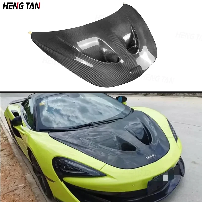 

For Mclaren 540 570s Carbon Fiber P1 Style Car Front Bumper Engine Cover Hood Bonnet Vent Parts Upgrade Body kit