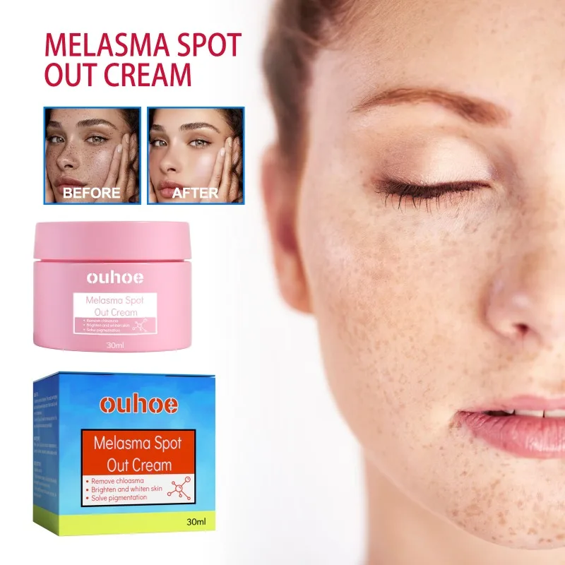 Melasma Spot Out Cream Reduce Melanin Fade Fine Lines Lighten Dark Skin Moisturize Hydrate Skin Serum Firming Brightening Cream