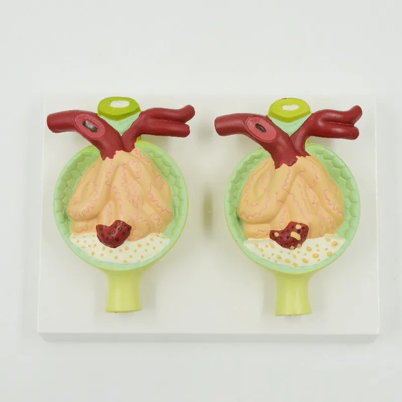 

Teaching Urine Protein Pathology Demonstration Teaching Model for Medicine