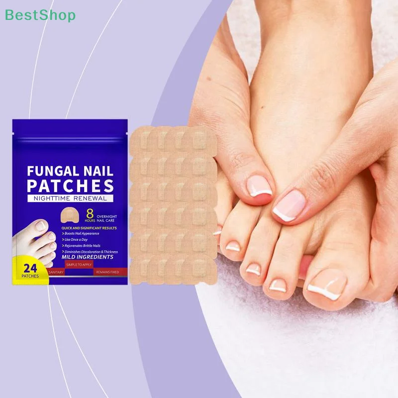 مسمار إصلاح بقع أظافر الفطريات التصحيح لزجة أظافر الرعاية مسمار نام تصحيح ملصق بارونيشيا علاج الأظافر التصحيح