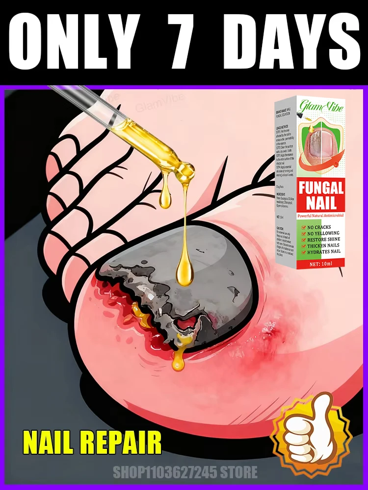 

Qᴜɪᴄᴋʟʏ ᴇʟɪᴍɪɴᴀᴛᴇ ғᴜɴɢᴜs ᴀɴᴅ ʀᴇsᴛᴏʀᴇ ʜᴇᴀʟᴛʜʏ ɴᴀɪʟs