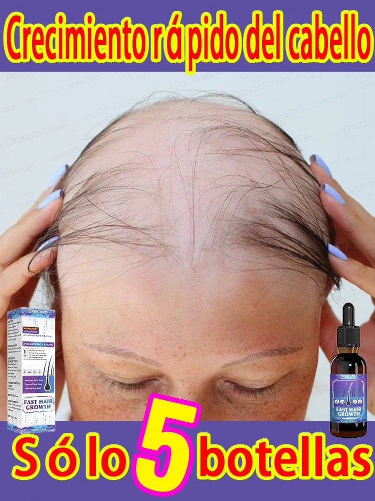 

Say goodbye to baldness and ʰᵃⁱʳ loss without damaging the scalp ʰᵃⁱʳ follicles.