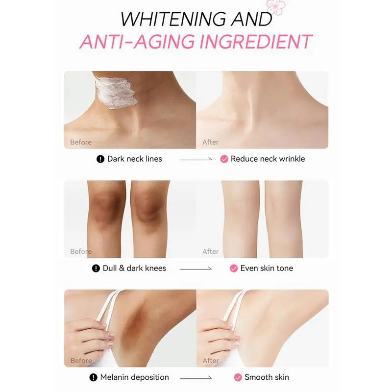 Body Whitening Cream Removing Deposited Melanin Lighten Underarm Knee Thigh Inner Joint Dark Melanin Bleach Brighten Lotion