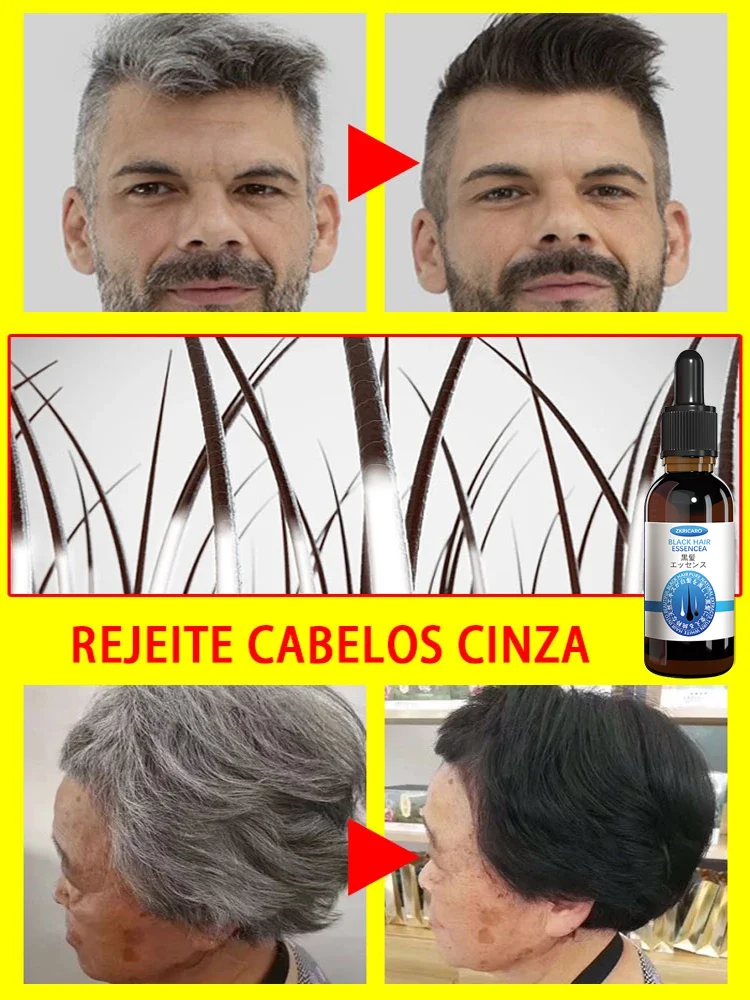 Suero para el tratamiento del cabello gris, blanco a negro, Color Natural, reparación, productos nutritivos, cuidado anticaída del cabello, hombres