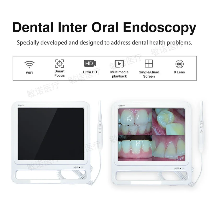 Intra‑Oral Visual Inspection All‑in‑One Unit, Ultra‑High Definition Image Shooting Device with Matching Station‑Mount Support Fr