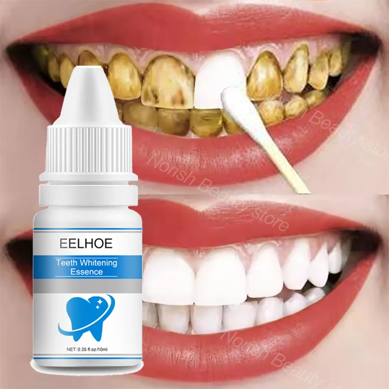 Soro de clareamento dental eficaz, removedor de manchas de placa, remoção de manchas de dente amarelo, hálito fresco, limpeza dental oral, cuidados de branqueamento