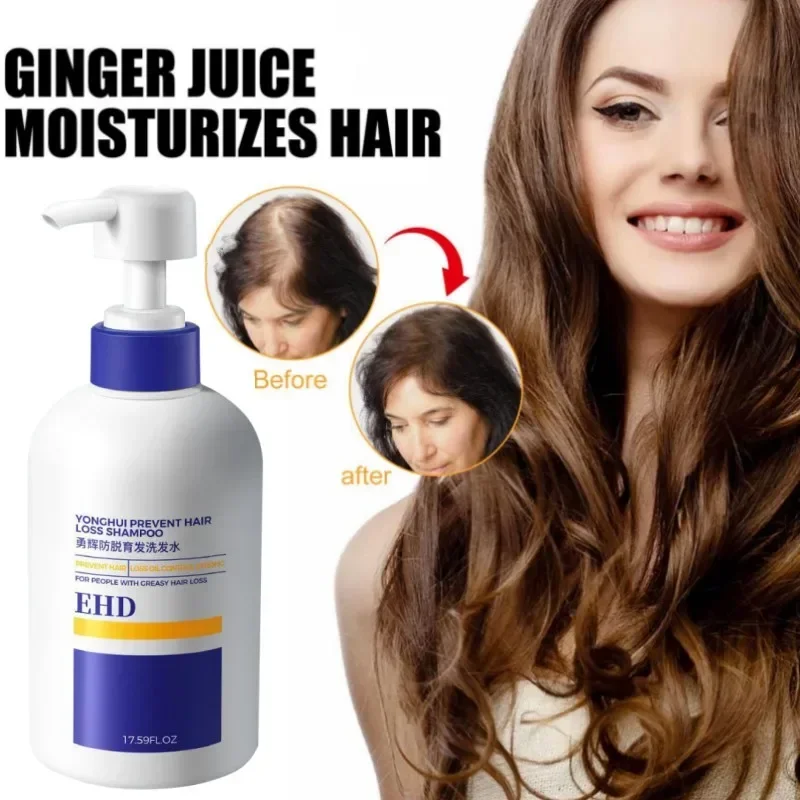 

Natural Organic Anti-hair Loss Hair Shampoo Nourishes Scalp Roots Fights Hair Loss Promotes Dense Growth Strengthens Hair 500ml