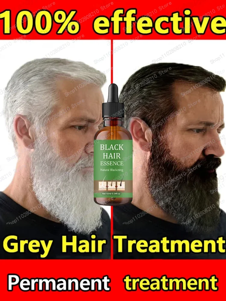 

Health with Anti-Grey Hair Essence Serum Treatment Revitalize Your Ahair Essence Serum Treatment Restore Natural Hairand 23 0903