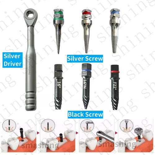Imagen 1 del producto Extractor de tornillos de implantes rotos, trinquete de conductor Dental, Extractor de recogida de taladro inverso, accesorio fallido, elimina tornillos SOS
