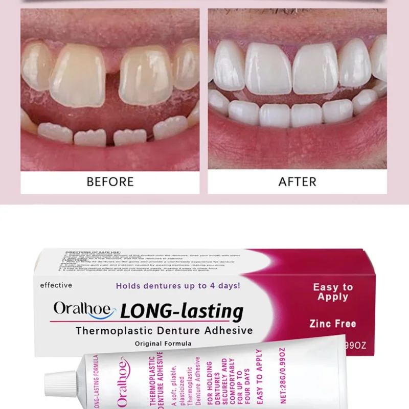 Denture Care Products Thermoplastic Denture Adhesive &cushion Reduce Gum Pain Caused Friction Fixed Dentures Enhance Comfort