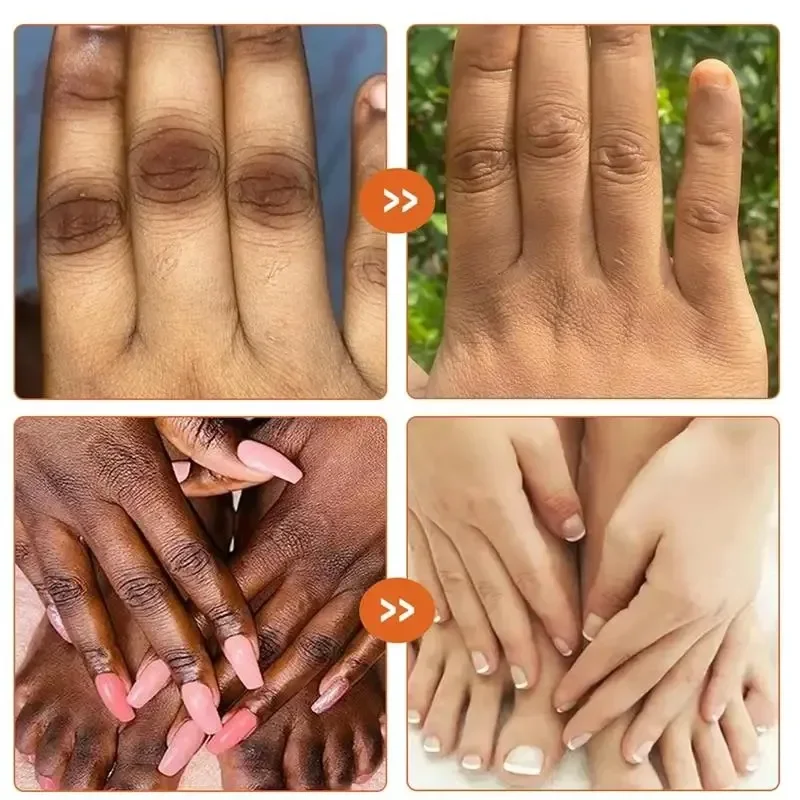 Donkere Knokkels Snel Helderen Serum Vrouwen Hand Knokkel Verlichting Melanine Essentie Ellebogen Knie Vervagen Product Verheldering Zorg