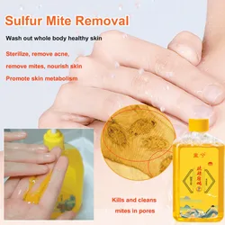 【Deep Cleaning and Mite Removal】Sulfur Mite Removal Shower Gel